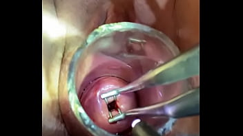 nude hard object insertion in anal