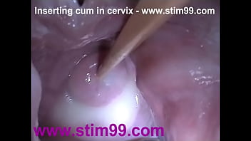 cervix play